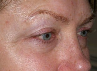 Patient 134 - Before View 