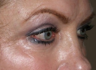 Patient 24 - After View 