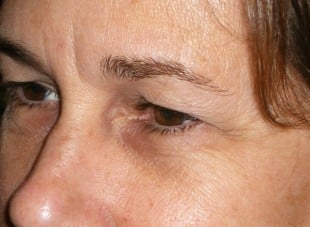 Patient 107 - Before View 