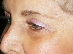 Patient 104 - After View 