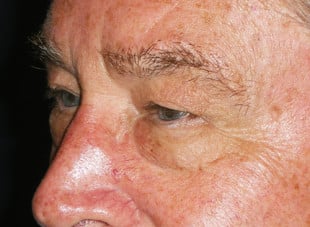 Patient 43 - Before View 