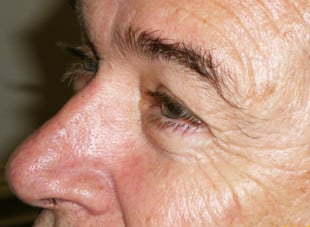 Patient 31 - After View 