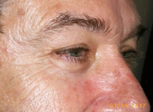 Patient 31 - After View 