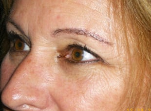 Patient 57 - Before View 