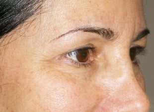 Patient 65 - Before View 
