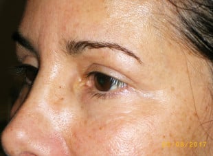 Patient 65 - After View 
