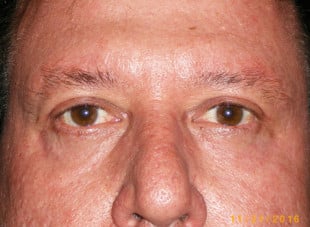 Patient 25 - After View 