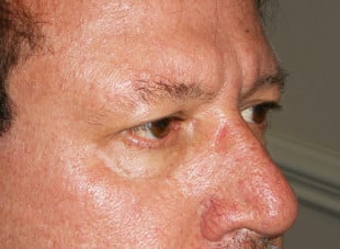 Patient 25 - Before View 