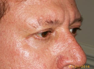 Patient 25 - After View 