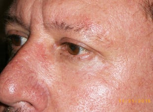 Patient 25 - After View 