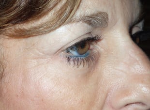 Patient 19 - After View 