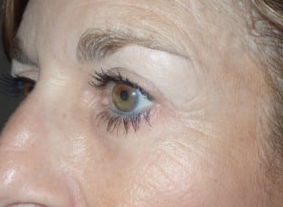 Patient 19 - After View 