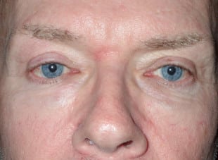 Patient 20 - After View 