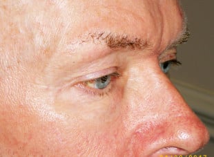 Patient 20 - Before View 