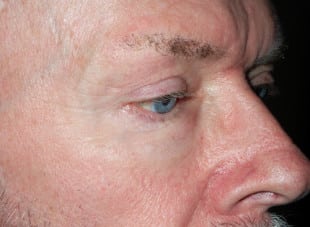 Patient 20 - After View 