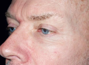 Patient 20 - After View 