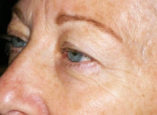 Patient 9 - Before View 