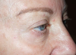 Patient 9 - After View 