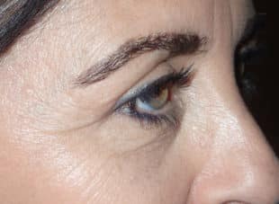Patient 12 - After View 